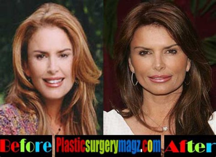 Did Roma Downey Have Plastic Surgery, Roma Downey Before And After