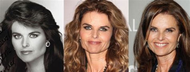 Has Maria Shriver Had Plastic Surgery? Truth Revealed Here!
