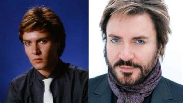 Has Simon Le Bon Had Plastic Surgery? Who is Simon Le Bon?